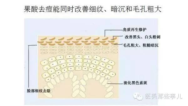 痘痘厉害怎么办