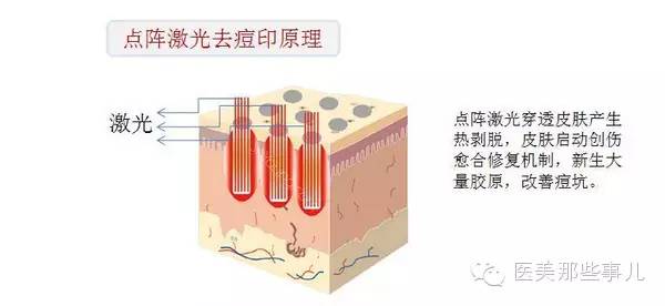 痘痘厉害怎么办