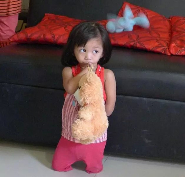 这个3岁的小女孩叫紫水晶桑托斯,来自菲律宾的马尼拉 ,她从诞生起就