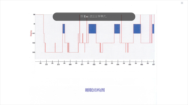 测睡眠的原理是什么意思_睡眠早醒是什么原因