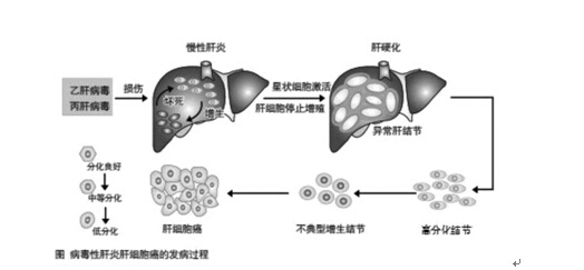 病理状态 搜狐网