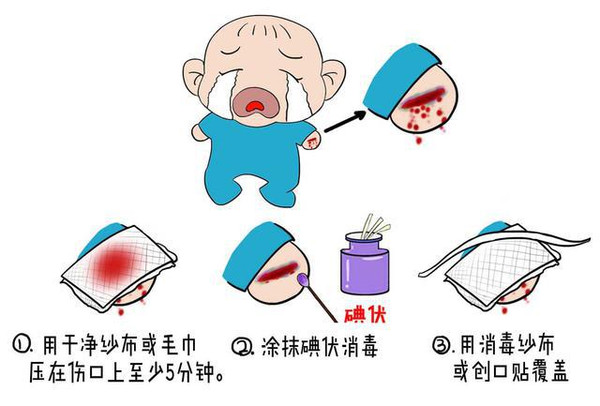 妈妈赶快转发:最全的儿童外伤急救方法