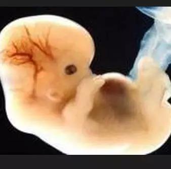 婆婆逼怀孕媳妇吃转胎丸 结果产下双性婴儿