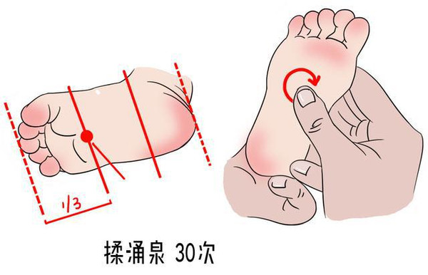 家庭医疗:快速正确处理小儿鹅口疮