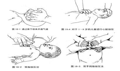 如果神智未恢复,继续胸外心脏按压. 儿童窒息抢救流程图