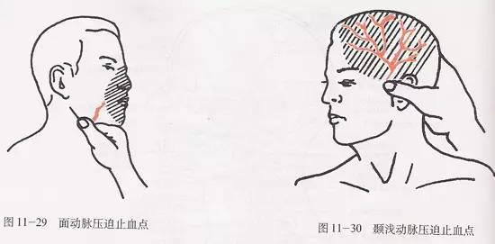 颞浅动脉由颈处动脉何处发出( ) a.平舌骨大角尖b.