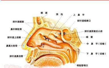 鼻咽癌检查的方法