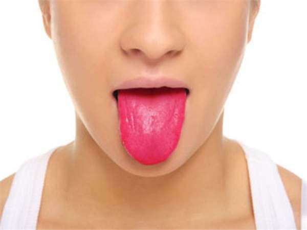 9种舌头透露出来的健康征兆,你够了解你的舌头吗