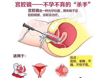 宫腔镜检查让不孕不育治疗有了方向