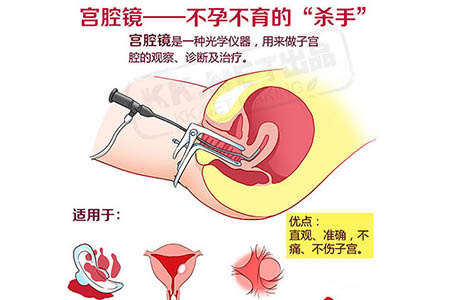 宫腔镜检查让不孕不育治疗有了方向