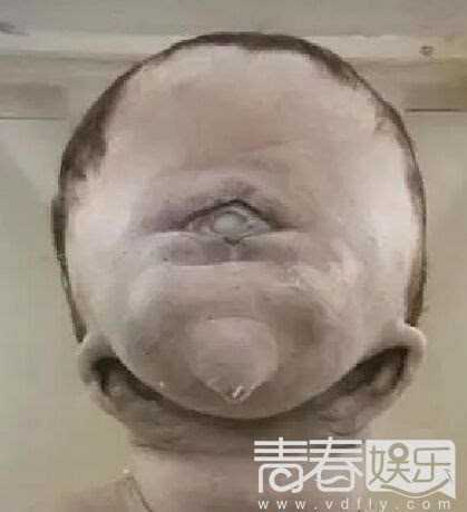 克隆失败的畸形婴儿