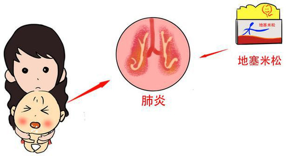 小儿发热,最快速有效的退热方法