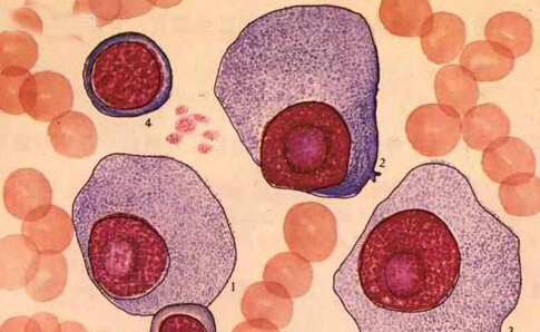 小鼠树突状细胞与骨髓瘤细胞融合瘤苗衍生exo