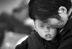 男童误吃96片止泻药导致失明