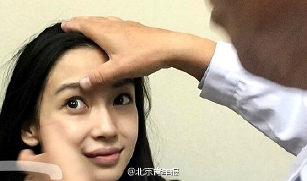 angelababy做臉部審定