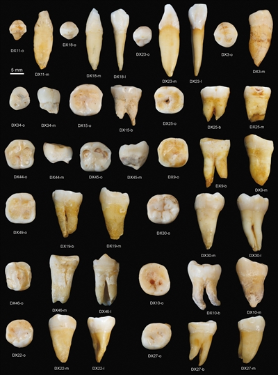 湖南道县发现47枚牙齿化石 距今8万-12万年(组图)