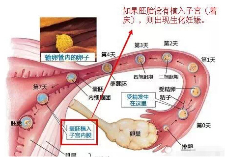 导致精神过度紧张,产生严重的焦虑情绪,这也会影响受精卵的着床过程