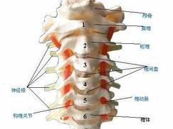 寰枢关节半脱位却被认为是落枕