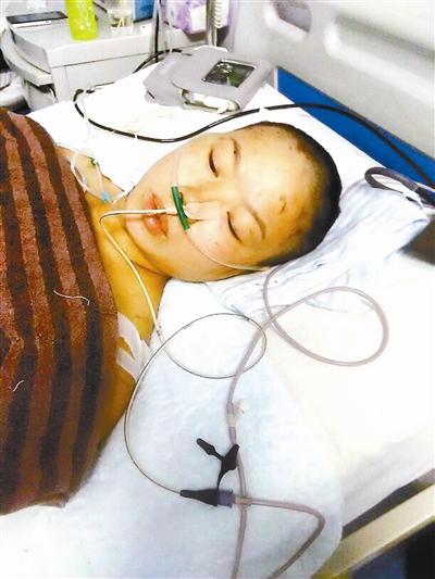 李娟仍在重症监护室期待植皮手术