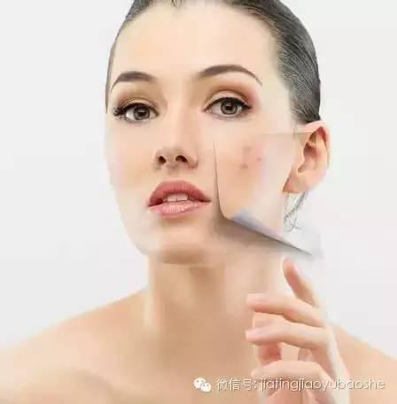 满脸青春痘怎么办