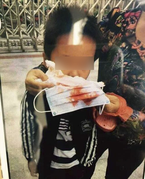 温州一小学操场刚铺塑胶 多学生头晕流鼻血(图