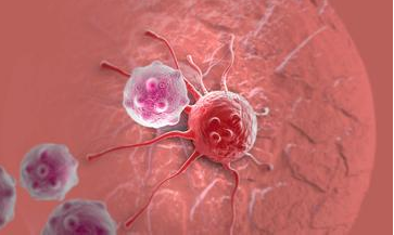 基于人体细胞免疫的疗法将成为肿瘤治疗新方向