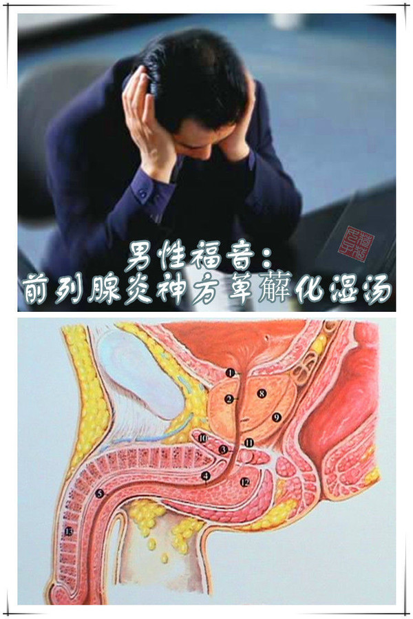 小腹及会阴胀痛加川楝子,救必应,乳香,没药各10g;前列腺液有脓球加