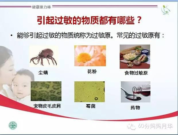 上海儿童医院皮肤科主任教你宝宝湿疹的治疗和