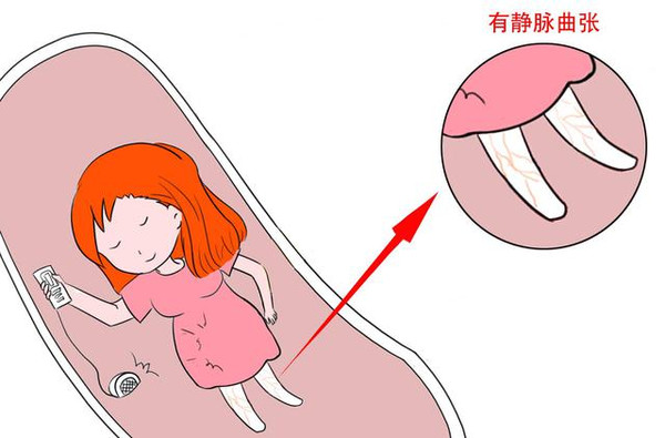 a身体!身体怀孕后学校的五大v身体,你变了么?囧事漫画女人图片