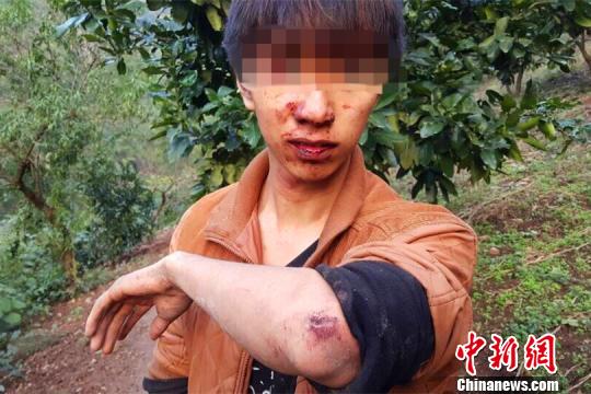 男子深山游玩遇野猪叫喊被“吓落”山崖(图)