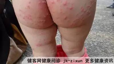 防止校园欺凌手抄报_如何防止性病