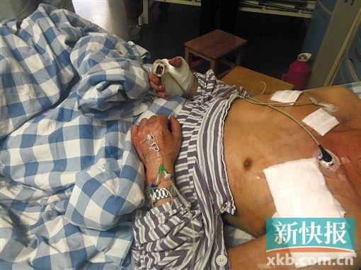 躺在病床上的小田满身可见多处刀伤。