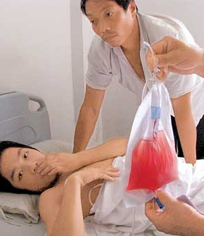 由肾脏恶性肿瘤引起的血尿往往在尿血时无尿道疼痛,出血呈间隙性但可