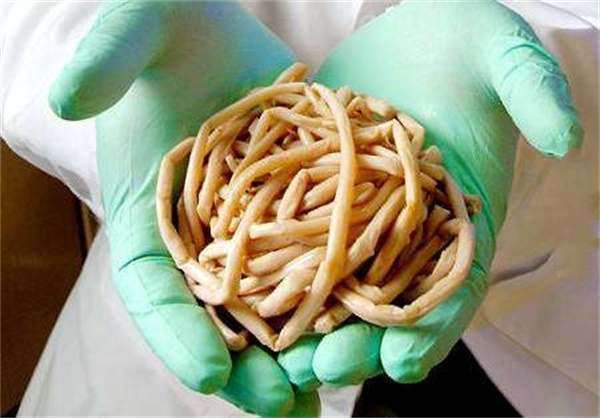 若身体有蛔虫,它们将住在你的肠道,若没有及时治疗会影响到其他器官如