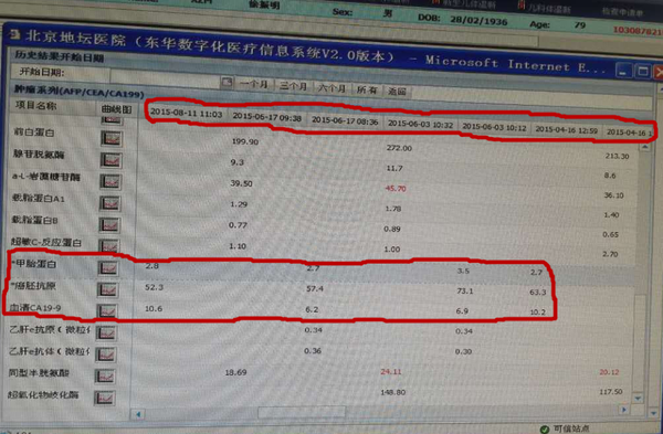 而癌胚抗原和血清ca19-9高,后经影像检查证实是原发性肝癌