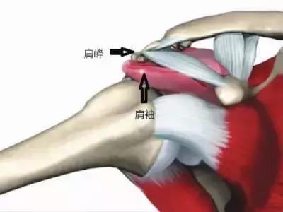 肩峰下撞击症和肩袖损伤是逐渐发展的过程,如果出现肩关节疼痛,早期