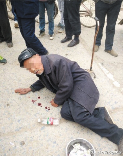 80岁老人街头吐血行乞经鉴定为染色剂(图)
