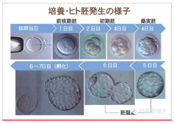 日本英医院试管婴儿受精卵培养过程及胚胎级别