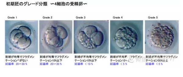日本英医院试管婴儿受精卵培养过程及胚胎级别-搜狐