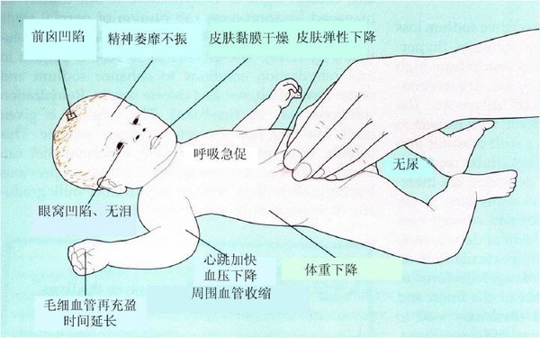 最实用的宝宝腹泻家庭治疗及用药指南