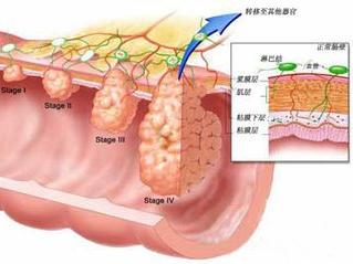 王晓英,解放军306医院,消化内科