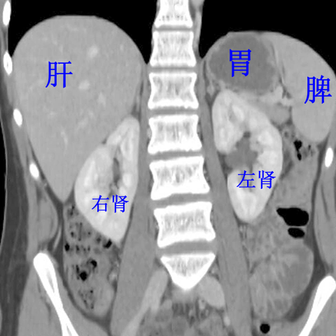 图示 人体腹部ct显示的肾脏 平台声明