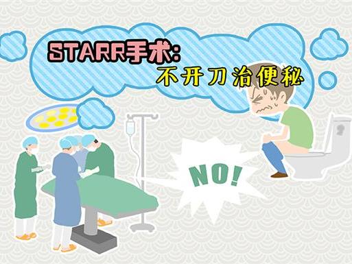 STARR手术不开刀治便秘