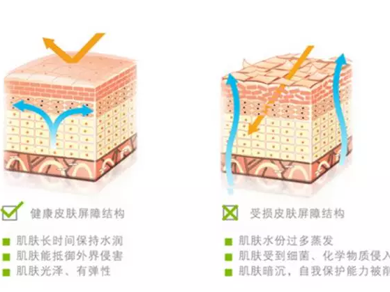 医用护肤品(修复皮肤屏障-保湿类)