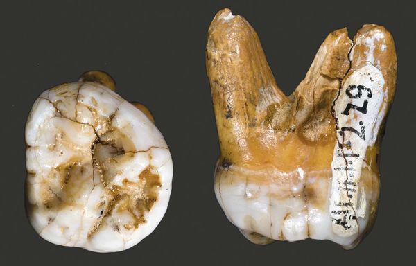 挖掘出早期人类牙齿化石,疑似中国人的祖先?
