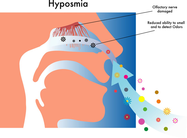 嗅觉障碍检测与神经系统疾病
