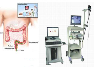 306医院专家谈无痛胃肠镜