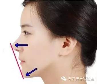 双下巴浮肿 每日3分钟的「侧脸美人」养成tips
