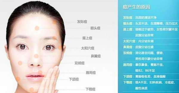 脸上长逗怎么处理 脸上长痘不挤能自愈吗