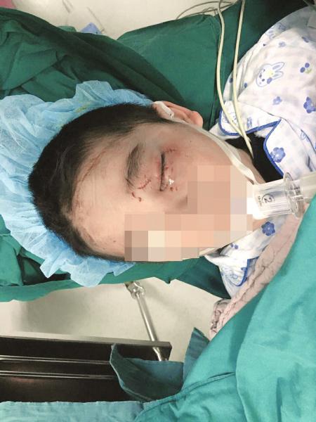 眼睛被人戳伤的4岁男孩强强正在医院接受治疗.
